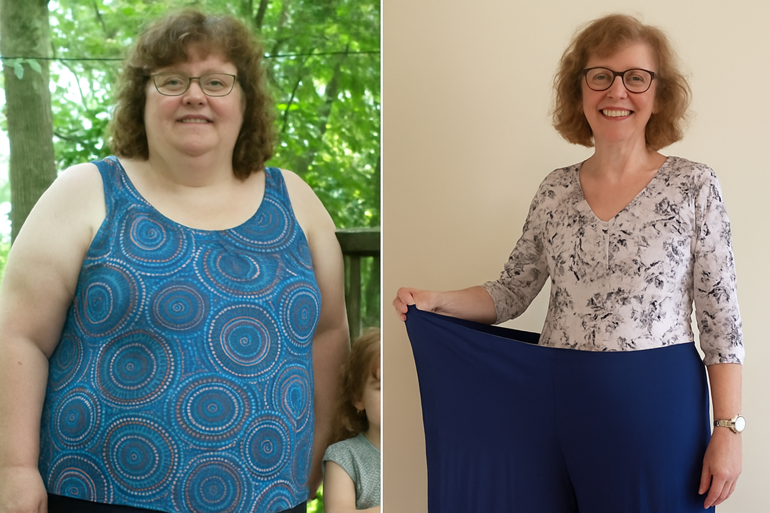 Susan Miller before and after Gelatide transformation