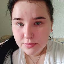 Aline Santos – Fortaleza/CE