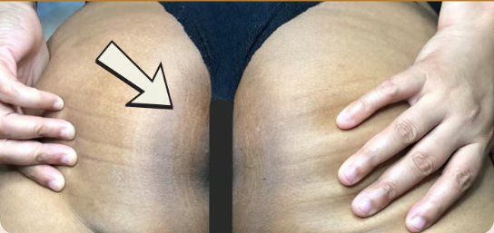 Después del protocolo